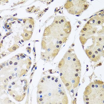 Immunohistochemistry - HNRNPL Polyclonal Antibody (144-08430)