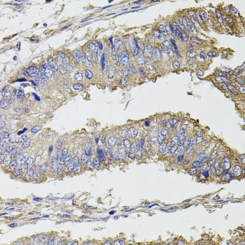 Immunohistochemistry - UBE2S antibody (144-04658)