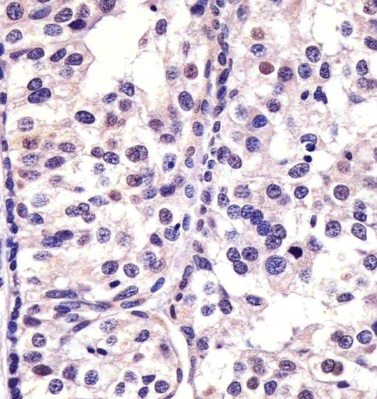 IHC-P