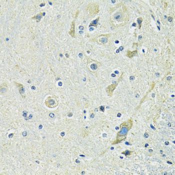 Immunohistochemistry - SLC1A4 antibody (144-12507)