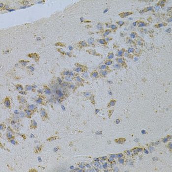 Immunohistochemistry - PSAP Antibody (144-01819)