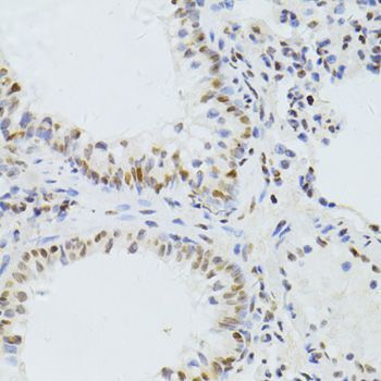 Immunohistochemistry - ALYREF antibody (144-06010)