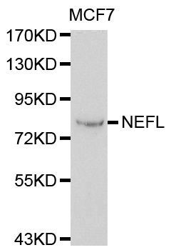 Western blot - NEFL Polyclonal Antibody (144-00257)