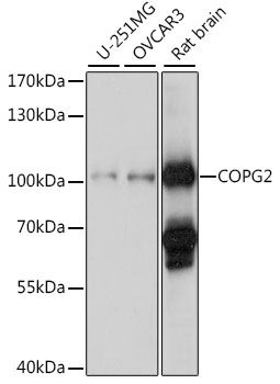 Western blot - COPG2 antibody (144-015816)