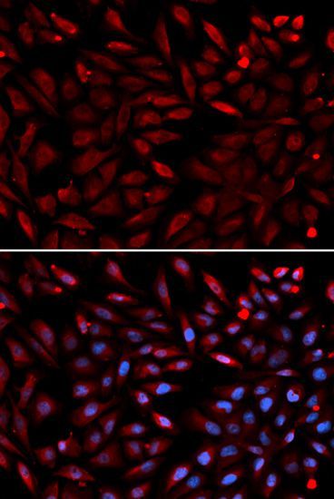 Immunohistochemistry - PSMC2 Polyclonal Antibody (144-01985)