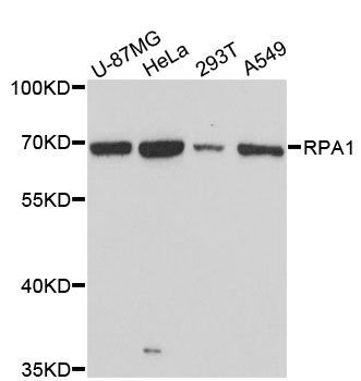 Western blot - RPA1 Polyclonal Antibody (144-60038)