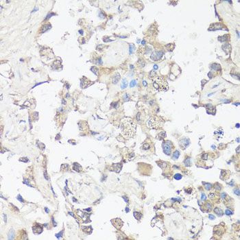 Immunohistochemistry - MAP1LC3B Polyclonal Antibody (144-11282)