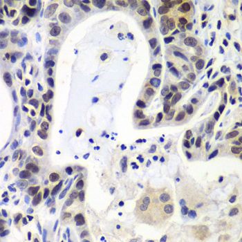Immunohistochemistry - LSM2 antibody (144-07988)