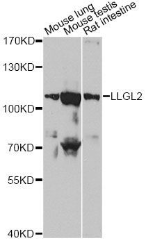 Western blot - LLGL2 Polyclonal Antibody (144-013323)