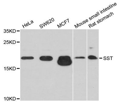 Western blot - SST antibody (144-09274)
