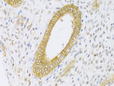 Immunohistochemistry - [KO Validated] RAB27A Polyclonal Antibody (144-01934)
