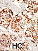 IHC-P