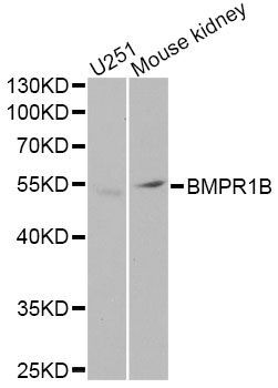 Western blot - BMPR1B Polyclonal Antibody (144-02005)