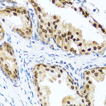 Immunohistochemistry - RAD23B Polyclonal Antibody (144-01034)