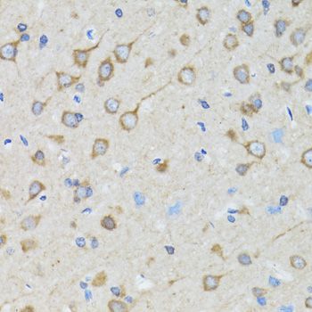 Immunohistochemistry - TOLLIP antibody (144-02202)