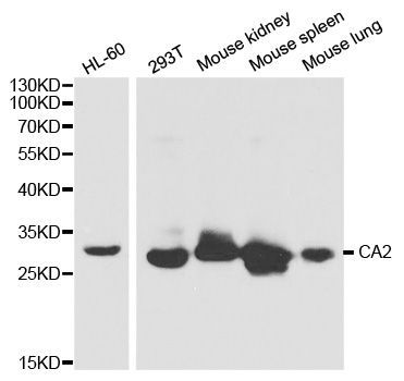 Western blot - CA2 Polyclonal Antibody (144-01440)