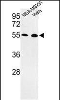 WB