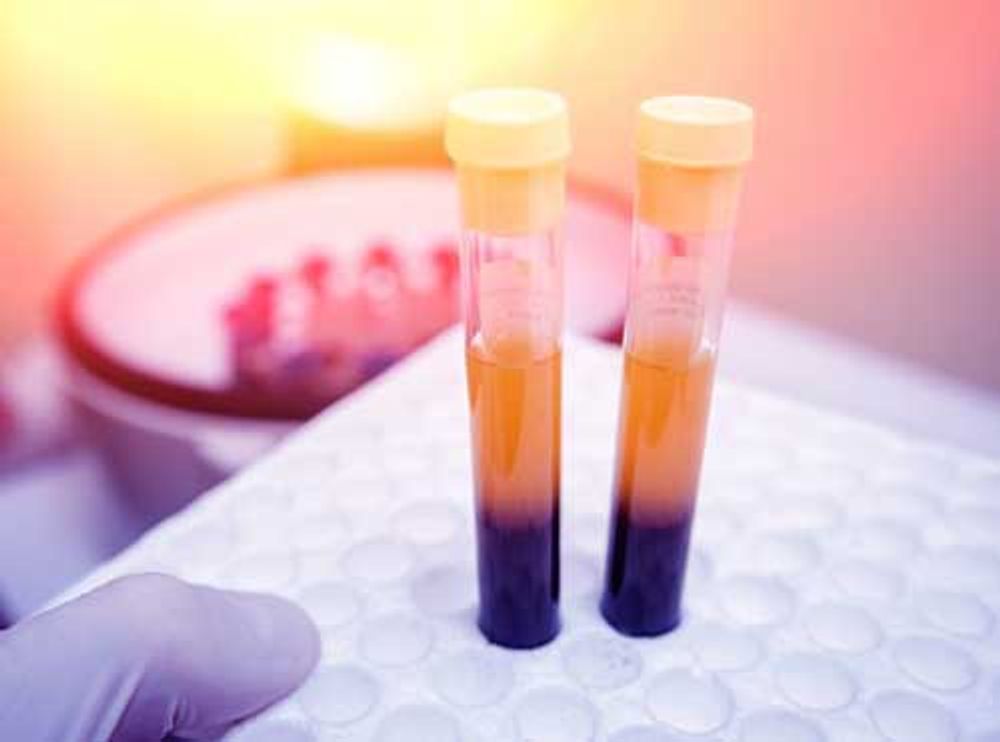 Serum and plasma tubes