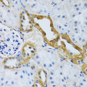 Immunohistochemistry - SLC4A5 Polyclonal Antibody (144-010436)
