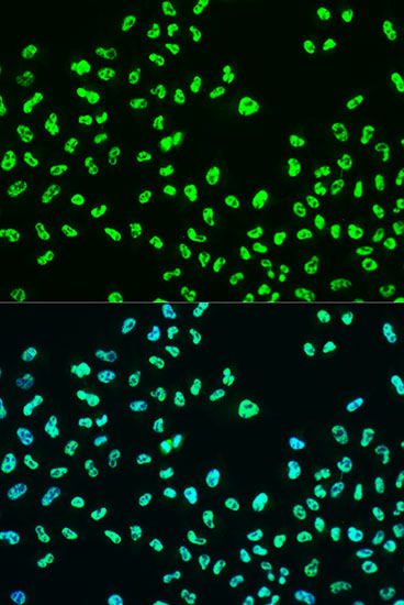 Western blot