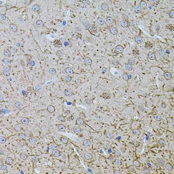 Immunohistochemistry - TEFM Polyclonal Antibody (144-08511)