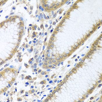 Immunohistochemistry - EIF4E Polyclonal Antibody (144-02162)