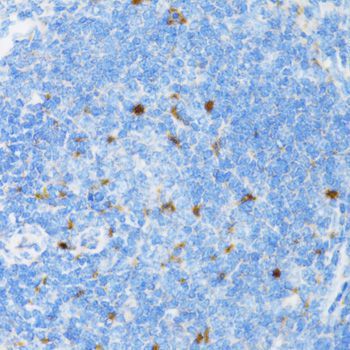 Immunohistochemistry - SIAH1 antibody (144-02494)