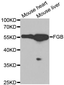 Western blot - FGB antibody (144-01401)