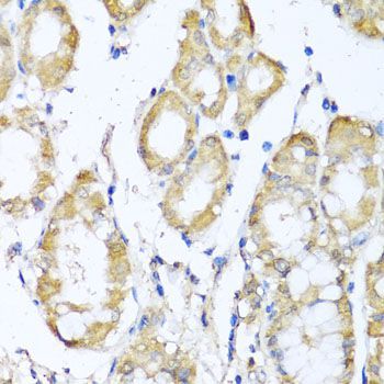 Immunohistochemistry - KCND2 Polyclonal Antibody (144-06203)