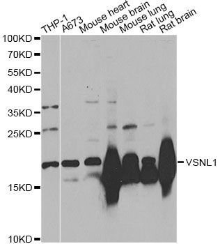 Western blot - VSNL1 Antibody (144-02797)