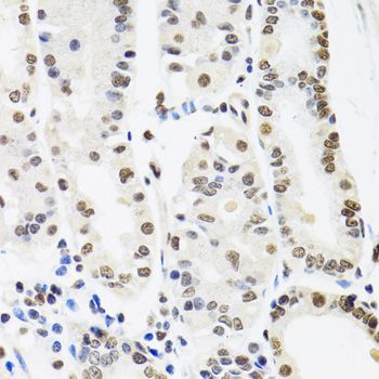 Immunohistochemistry - SFPQ Polyclonal Antibody (144-00958)