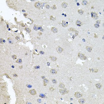 Immunohistochemistry - PKN1 Polyclonal Antibody (144-00553)