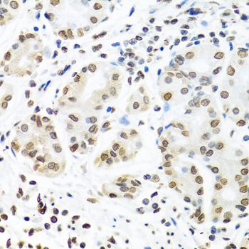 Immunohistochemistry - IGF2BP1 antibody (144-01517)