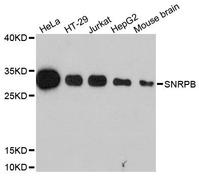 Western blot - SNRPB antibody (144-61328)