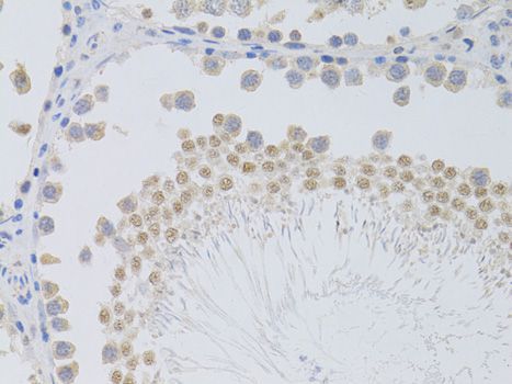 Immunohistochemistry - PHC1 antibody (144-05843)