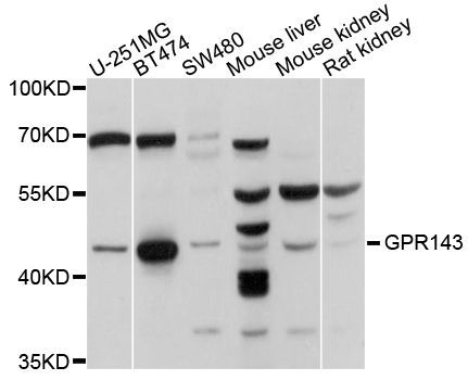 Western blot - GPR143 Polyclonal Antibody (144-010568)