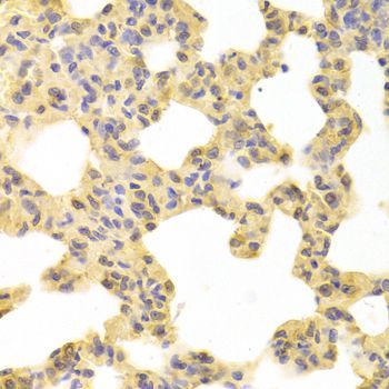 Immunohistochemistry - MAP2K1 Polyclonal Antibody (144-00252)