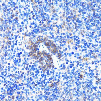 Immunohistochemistry - ACTR2 Polyclonal Antibody (144-05734)
