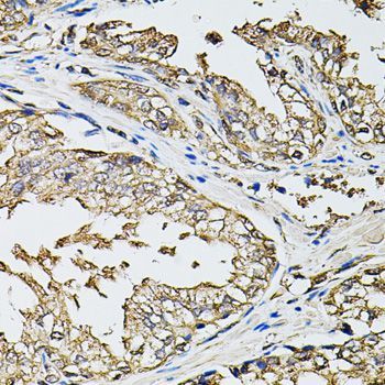 Immunohistochemistry - RASSF5 Polyclonal Antibody (144-07389)