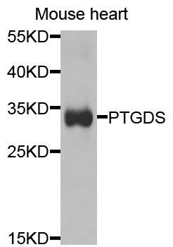Western blot - PTGDS antibody (144-01889)