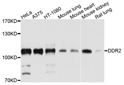 Western blot - DDR2 Polyclonal Antibody (144-10060)
