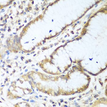 Immunohistochemistry - NUDT15 antibody (144-08368)