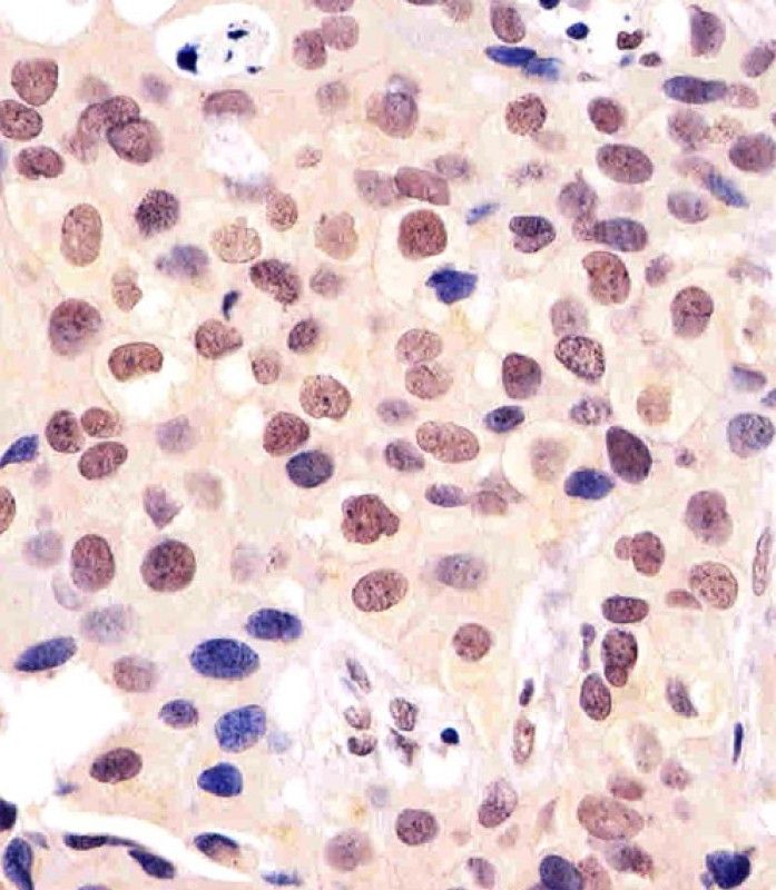 IHC-P