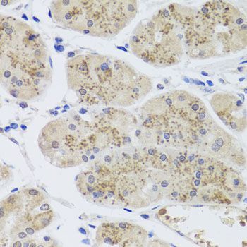 Immunohistochemistry - MTERFD3 antibody (144-08518)