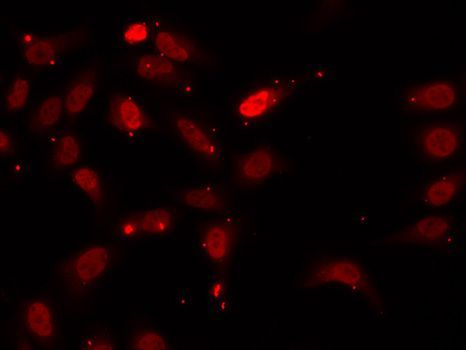 Immunofluorescence - HNRNPF Polyclonal Antibody (144-61419)