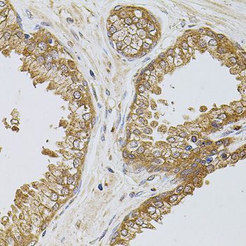Immunohistochemistry - TEFM Polyclonal Antibody (144-08511)