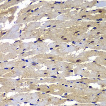 Immunohistochemistry - PSMB8 antibody (144-07340)
