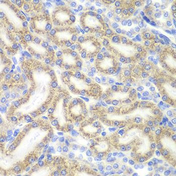 Immunohistochemistry - DAP Polyclonal Antibody (144-06150)