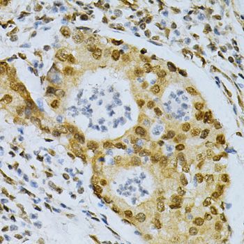 Immunohistochemistry - ELAVL1 Polyclonal Antibody (144-01608)