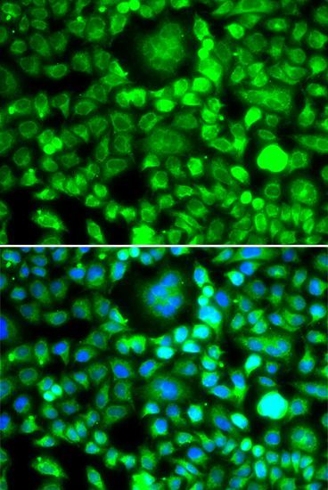 Immunofluorescence - BLID Polyclonal Antibody (144-07275)
